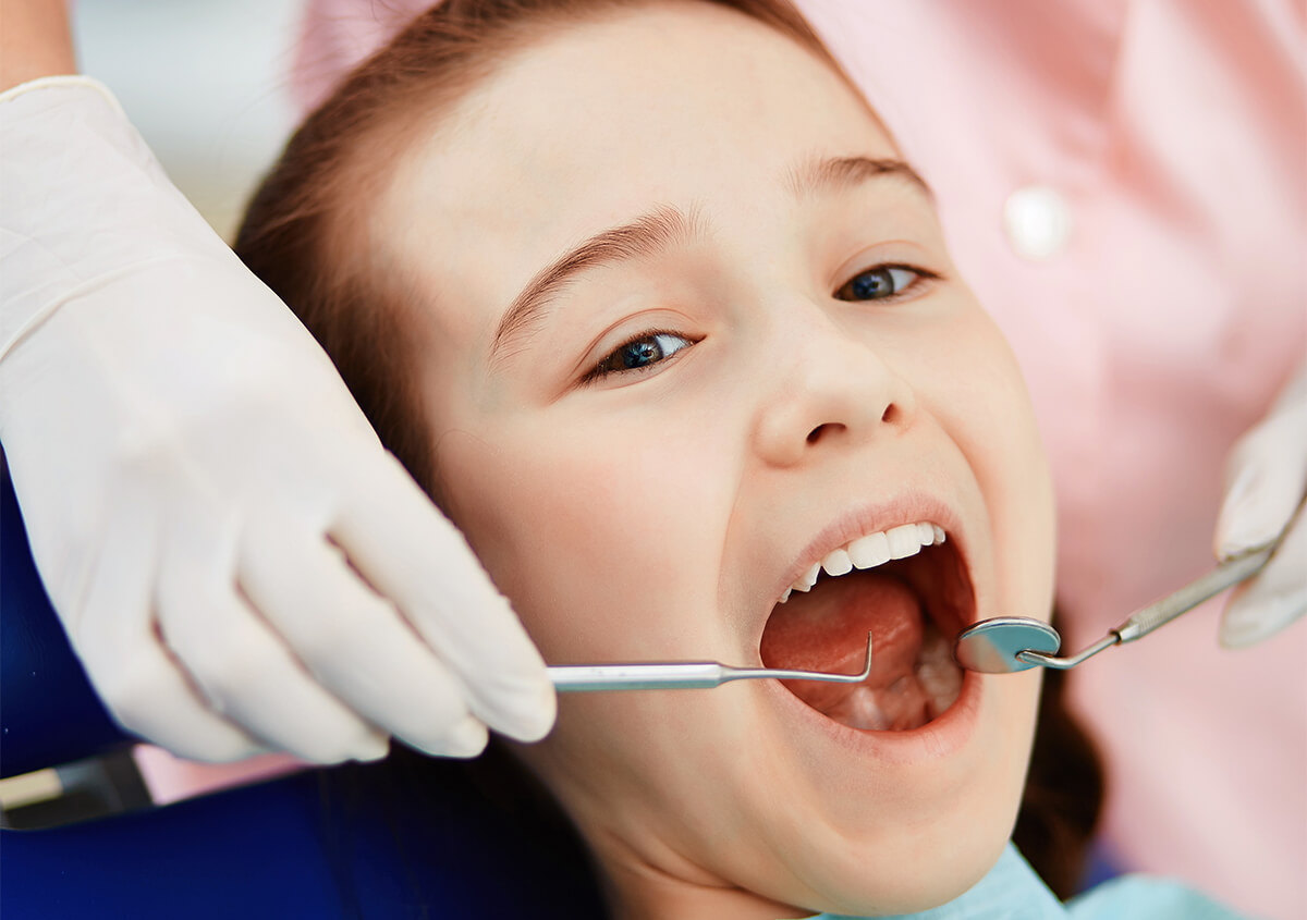 Dental Cavity Filling in Spring TX Area