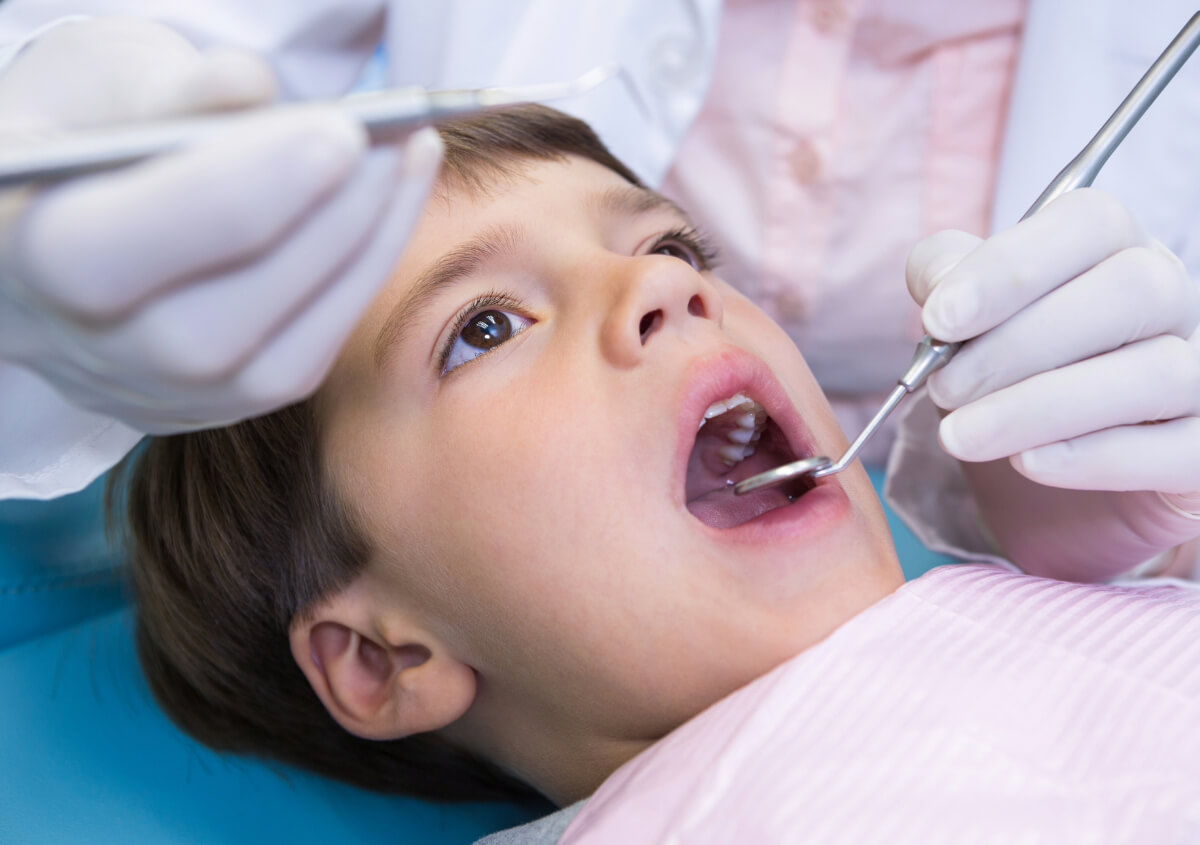 Dental Sealants for Kids in Spring TX area